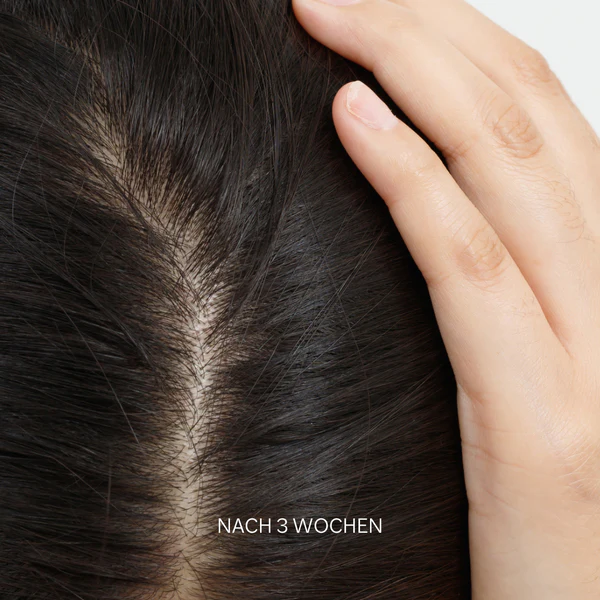 Neu2_Produktseite_Scalp_Hair_Detox_Mask_Nachher_600x
