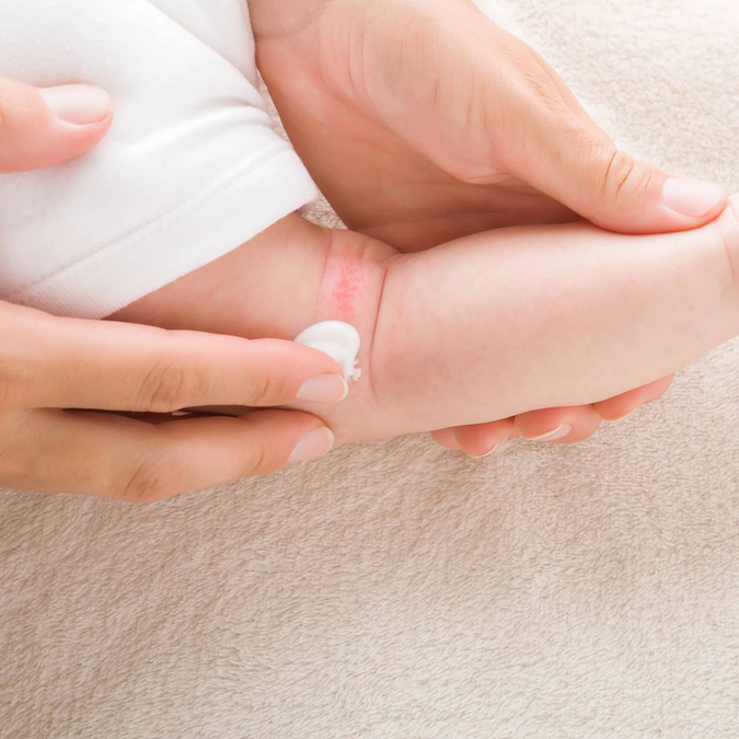 baby-creme-wund-2