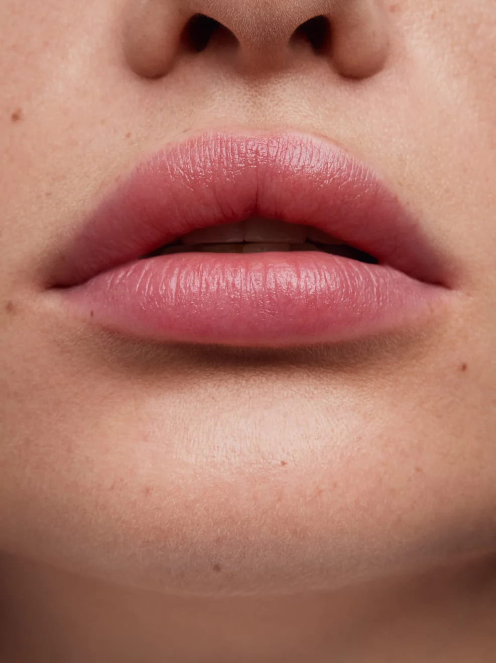 UG_TAGAROT_Balm_Acai_after_988x1319_1